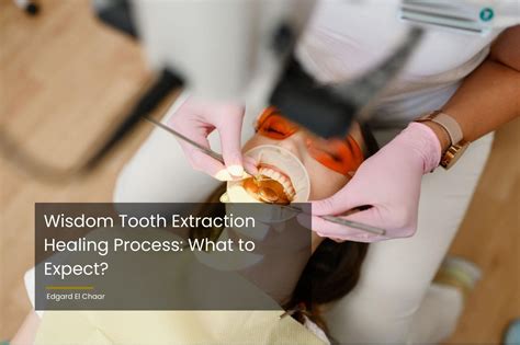 Image result for Healing Process of Tooth Extraction