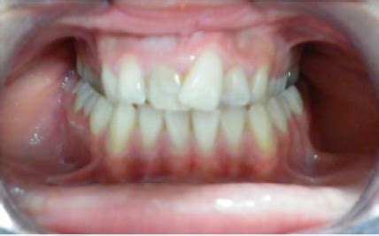 Smile Arc Treatments available in smile arc dental vijayawada