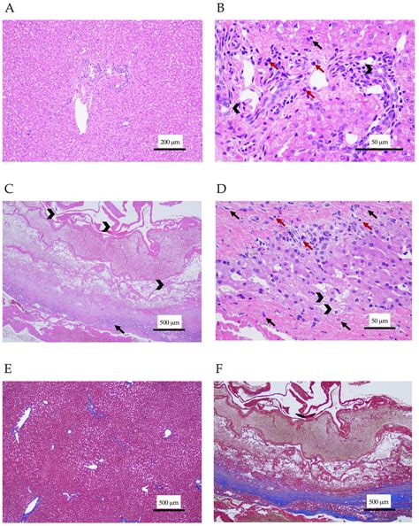 Feline Cyst-like Lymphocytic Cholangiohepatitis in a Cat: First Case Report