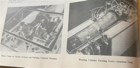 Bench Grass: A Medico-Technical Appendix to Postblogging Technology, July 1953: Heart-Lung ...