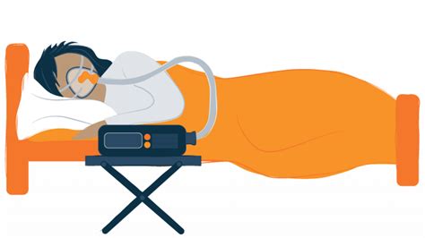 CPAP Alternatives - 10 Other Ways to Relieve Obstructive Sleep Apnea