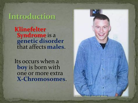 Klinefelter syndrome.pptx