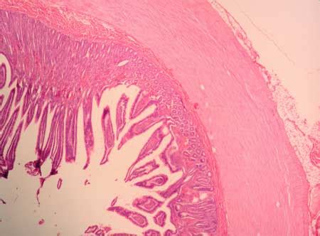 Image result for Jejunum Microscope