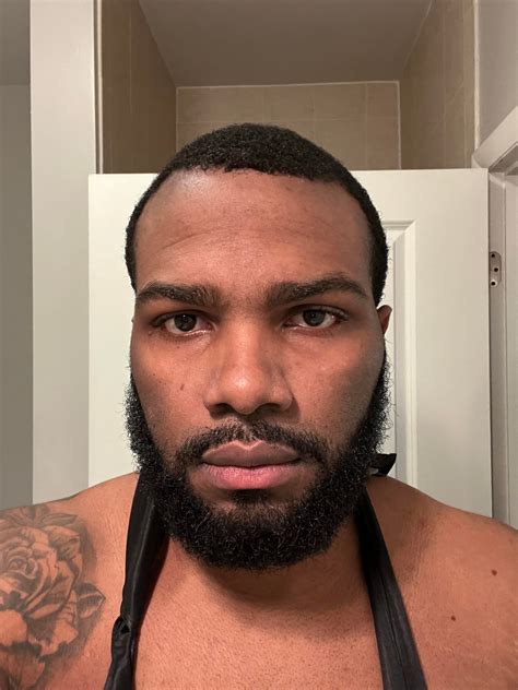 4 1/2 months Min oral and topical, fin & dermarolling once a week for 3 ...