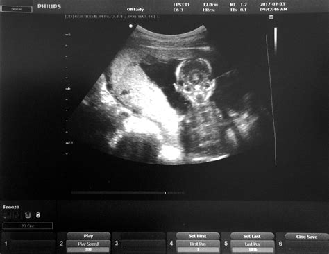 Image result for Alien Monkey Baby