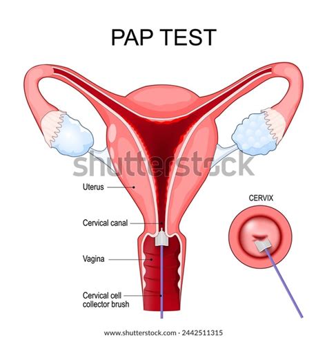 Image result for Pap Test Animation