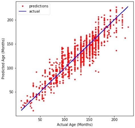 Skeletal age evaluation using hand X-rays to determine growth problems ...