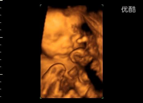 宝宝22周做四维彩超的录像1-母婴亲子视频-搜狐视频