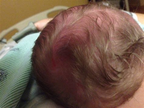 My squishy, cone headed baby birth story! — The Bump