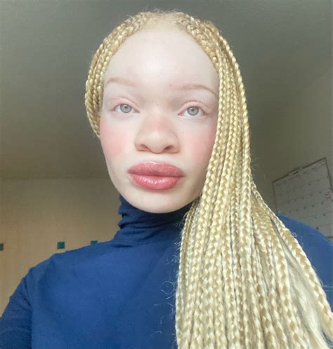 Pin by Uchenna Maduh on Jan22 | Albino girl, Pretty people, Unique faces