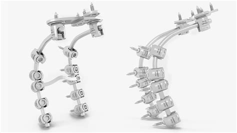 3D model Posterior Cervical Spine Fixation System | 3D Molier International