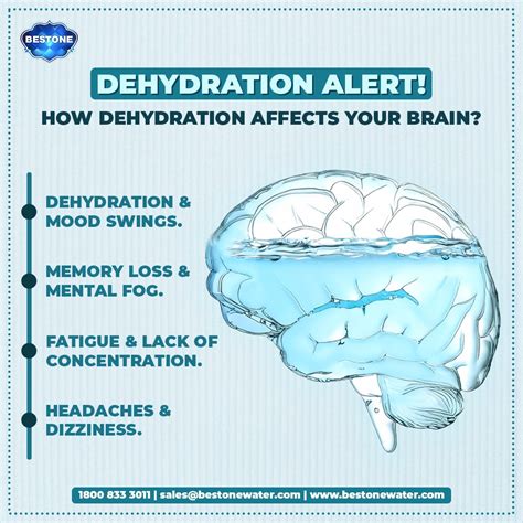 Dehydration Headache Location