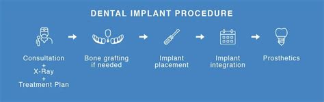 Dental Implants in Ahmedabad | Dental Implants Near You | Cost of ...