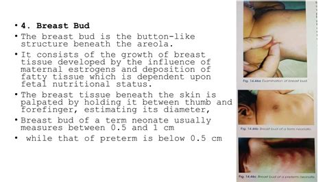 What Are Breast Buds