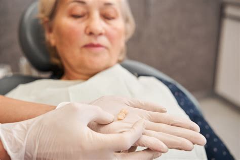 Image result for Tooth Extraction Pain Relief