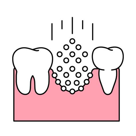 Image result for Pulp Extraction Tooth