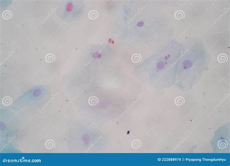 Histological Sample Squamous Epithelial Cells Under Microscope. Stock ...