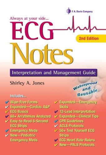 Buy ECG Notes: Interpretation and Management Guide Book Online at Low ...