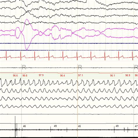 Image result for Measuring Sleep