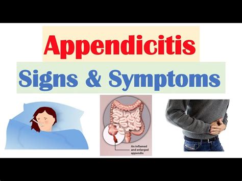 Image result for Appendix Pain Area