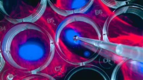 Indian researcher develops human brain cells in a dish to study complex ...