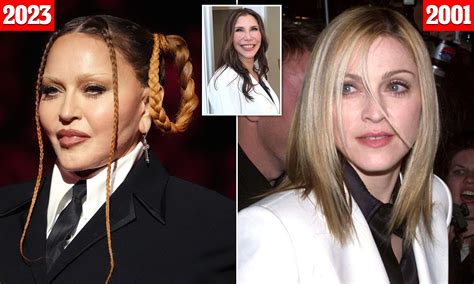 Madonna Surgery Face