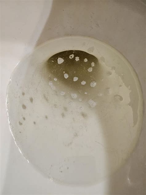 56 best r/foamyurine images on Pholder | Normal upcr and uacr tests. Does anyone else have foamy ...