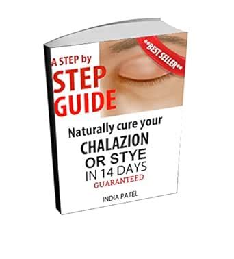Step by step guide Naturally cure your chalazion or stye in 14 days ...