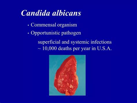 Image result for Opportunistic Pathogen