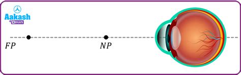 Human Eye: Defects, Apparent size, Accommodation & Correction | AESL