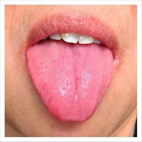舌诊太简单了：舌头颜值高就健康，舌头长得丑，注意疾病_多马手诊养生