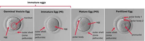 Everything you need to know about egg maturity - Inside IVF