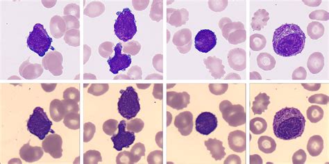 HemaBook Chapter 12: A Clearer Truth? Find it Faster! - Mindray India