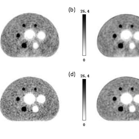 Image result for Iterative Reconstruction Osem