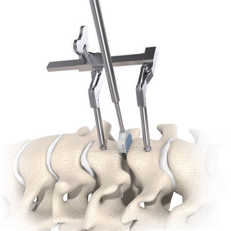 Image result for Cervical Rotators