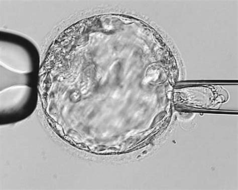 Academy of Clinical Embryologists – Promoting Clinical Embryology by ...
