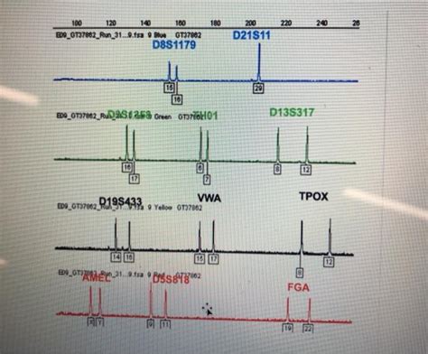 Electropherogram Interpretation 的图像结果