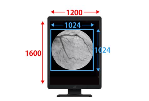 医用モニターの選び方と価格 | 役立つコンテンツ一覧 | 医用モニター / 産業用モニター | JVC
