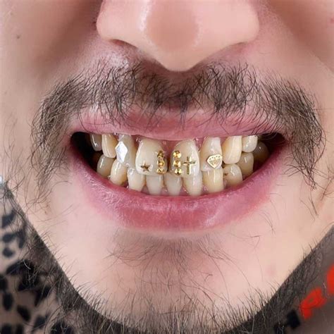 Image result for DIY Tooth Gems