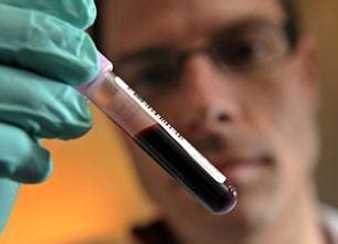 Cuáles son los valores normales de los basófilos