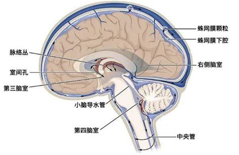 CT查出脑室大，不一定是脑积水|CT片子|脑积水|脑脊液|脑室|-健康界