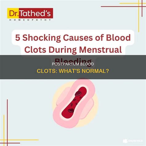 Postpartum Blood Clots: What's Normal? | ShunChild