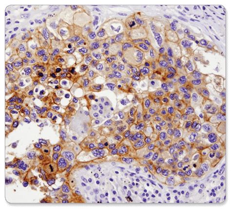 Image result for IHC Staining