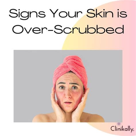 Over-Exfoliation: How Excessive Scrubbing Can Damage Skin | Clinikally
