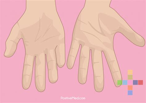 Image result for Blood Circulation Problems