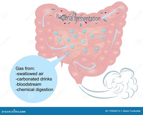 Gas Flatulence Bloating at Nancy Colon blog