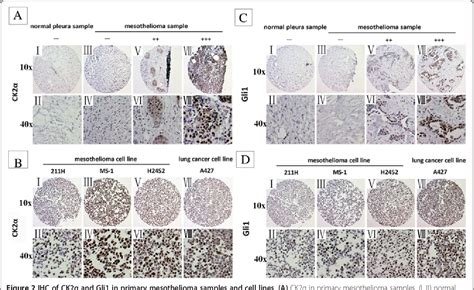 End Stage of Emphysema 的图像结果