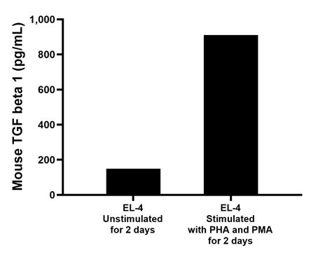 Mouse TGF beta 1 Recombinant Matched Antibody Pair, PBS Only antibody ...