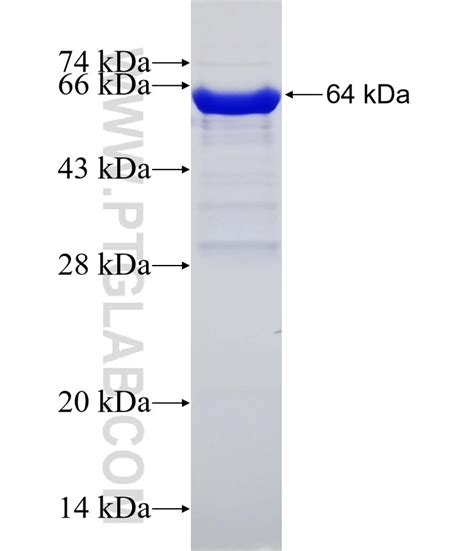 ANPEP Fusion Protein Ag5976 | Proteintech