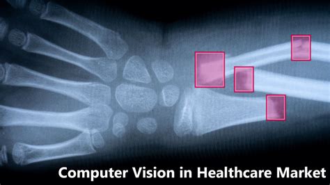 Image result for Computer Vision Oclusion